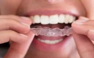 Qué es el bruxismo. Síntomas y causas