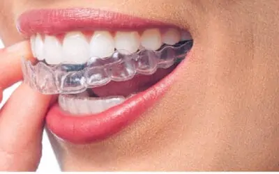 Te traemos Invisalign – El camino más rápido hacia una sonrisa perfecta